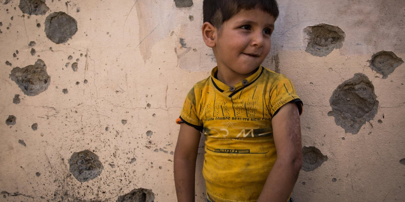 Photo : Tom Peyre-Costa
Kaiwan got his left arm burned when Islamic State group fighters attacked his neighborhood.