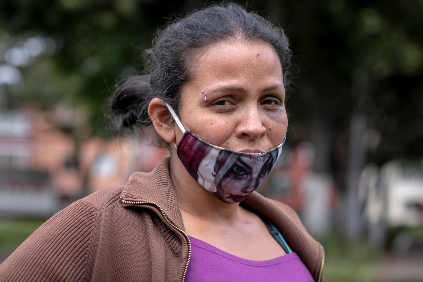 June 25, 2020. Bogota, Colombia: Angie Carolina Burgosa (33) has been in Colombia for four years. She has 10 children. In Venezuela the situation became hard for her family. Food shortages began to affect her children to the point that they had a faded fight. "They were dehydrated," she says. "When I saw my children like that, we went to a farm... to steal some cattle... and in this theft I was almost killed. I mean, it was a terrible thing because I did it for my kids." That's what precipitated his departure from the country. She walked away with six of his children. She thought she would find help from the father of his children, a Colombian who had been displaced for a long time in Venezuela, and returned to Colombia. "He told me that he was going to help me with the children but... he turned his back on me later. 
She stayed on the street for a while. And social services took their kids away from her. Now she is living in a slum called "Paraiso", Heaven, with four of her daughters, elderly of 10 months, 3 years, 4 years and her 16 year old daughter who is also mother of a 2 years old, and made Angie a 33 year old grandmother. They live in one room and there is no water. "I have pots full of water.it must have done something to me because I got bone pain, I got the flu. It made me very sick. Then I said, "My God, I have me the Covid! (...) I took a pill, and my daughter made me lemon water with sugar can. And that made me better. I was able to get out of bed. Because I couldn't get out of bed."
In Venezuela, she had this plan to have her own restaurant. "At night I would sell coffee on the road. And by day, working in a restaurant." In Colombia, she worked a time in a fruit shop. "The lady treated me badly and paid me 20,000 pesos (5 dollars) per day, and she told me that this was only what Venezuelans were paid... She always humiliated me. "
"I decided not to work for anyone, because I worked in a family home and I was treated badly too. So I decided to sell garbage bags to the traffic lights.(...) During the quarantine, one week it arrived that because we were locked up in the house, the girl did not have a teapot. So I said: What do I do?!! Let's go out! And we decided to go out and I met a man and he gave us a food package." 
"A little while ago, about 15 days ago, there, where I live in Paraiso, there is a big school and they were going to give out food packages. I went. Because maybe I'm not Colombian but I'm human. I'm Venezuelan but I'm human. I respect everyone. So I went. Come on, Angie! And then, I was there. A man came and said. No, you are Venezuelan. Bastard! Gonorrhea [Colombian insult]! I asked: Why you treat me like this if I'm not messing with you! He was an old man but I think he was drunk. And 15 people came... to try to stab! A guy grabbed my hand and we started running! Finally the police arrived and they didn't manage to stab us. So now, if they're going to give something, I don't go near them because I'm Venezuelan and they can attack me!"
A similar story happened to her a few days before, with two of his daughters playing in a park. She was stabbed a few times, and a shiner in her left eye, which can be seen in the photos. "Like everything else, they always say "Venecos", they call us "Gonorrhea". Then already, stabbed, bleeding and beaten... my daughters crying (...) I grabbed my daughters and left. (...) My daughters decided now to stay in the house, locked up; for on Sunday, they did not want to leave." Credit: Nadège Mazars for NRC
